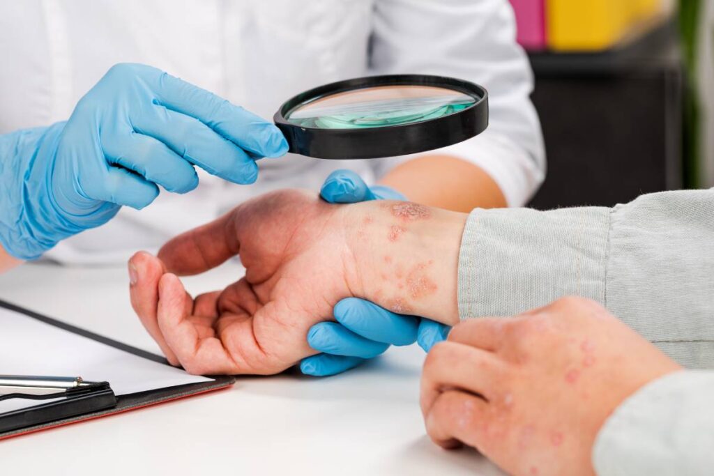 Understanding Fungal Infections