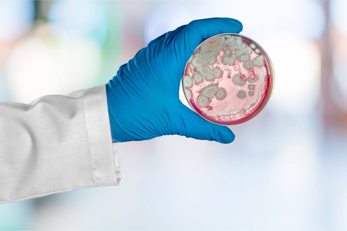 Tailored antiviral treatment