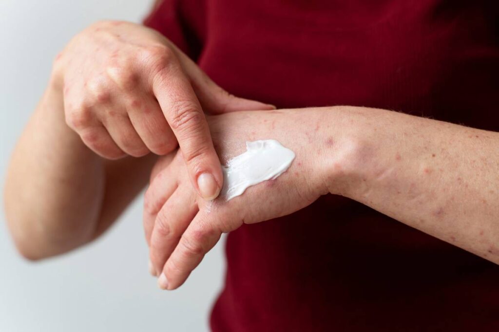 Skin allergy person